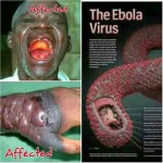 Ebola